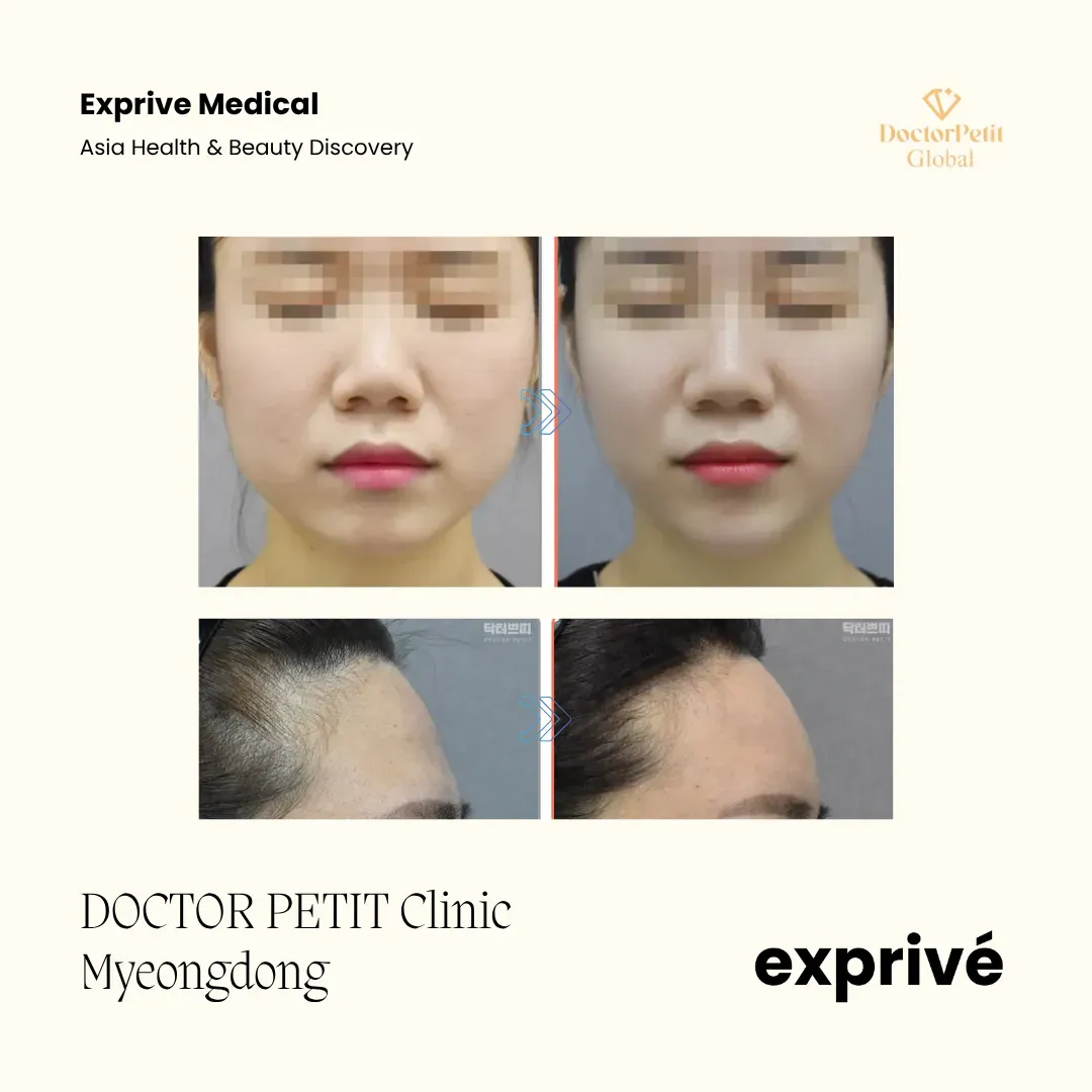 DOCTOR PETITクリニック明洞