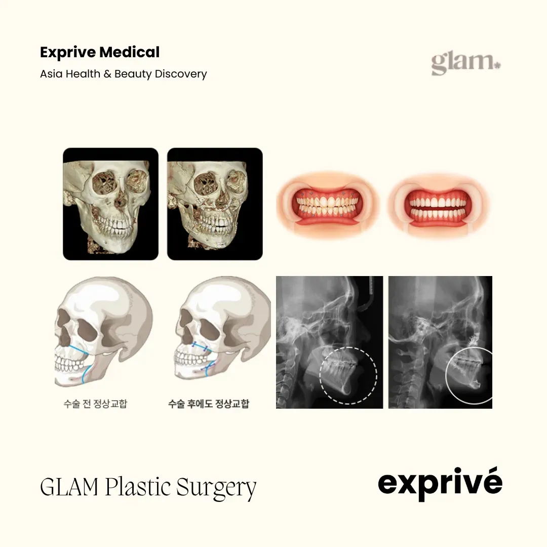 GLAM Plastic Surgery