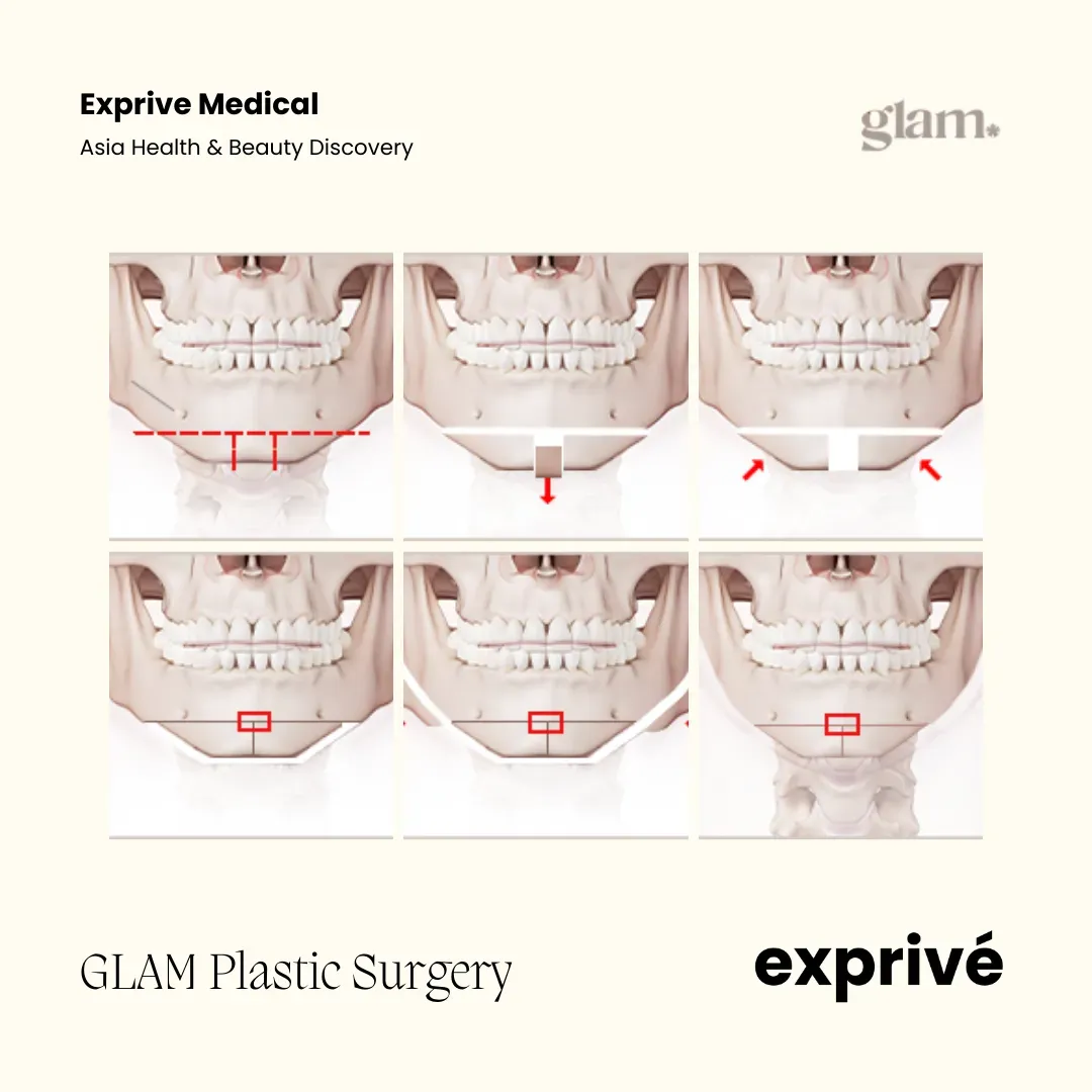GLAM Plastic Surgery