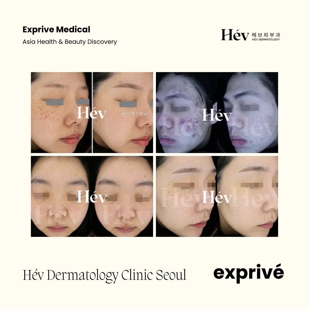 Hév Dermatology Clinic Seoul