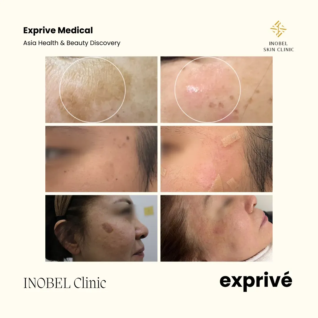 INOBEL Clinic