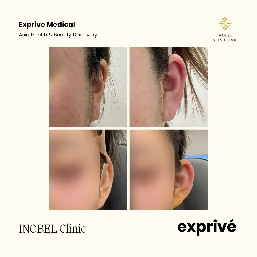 INOBEL Clinic
