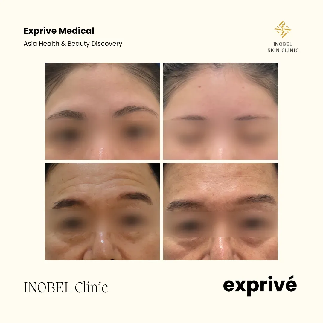 INOBEL Clinic