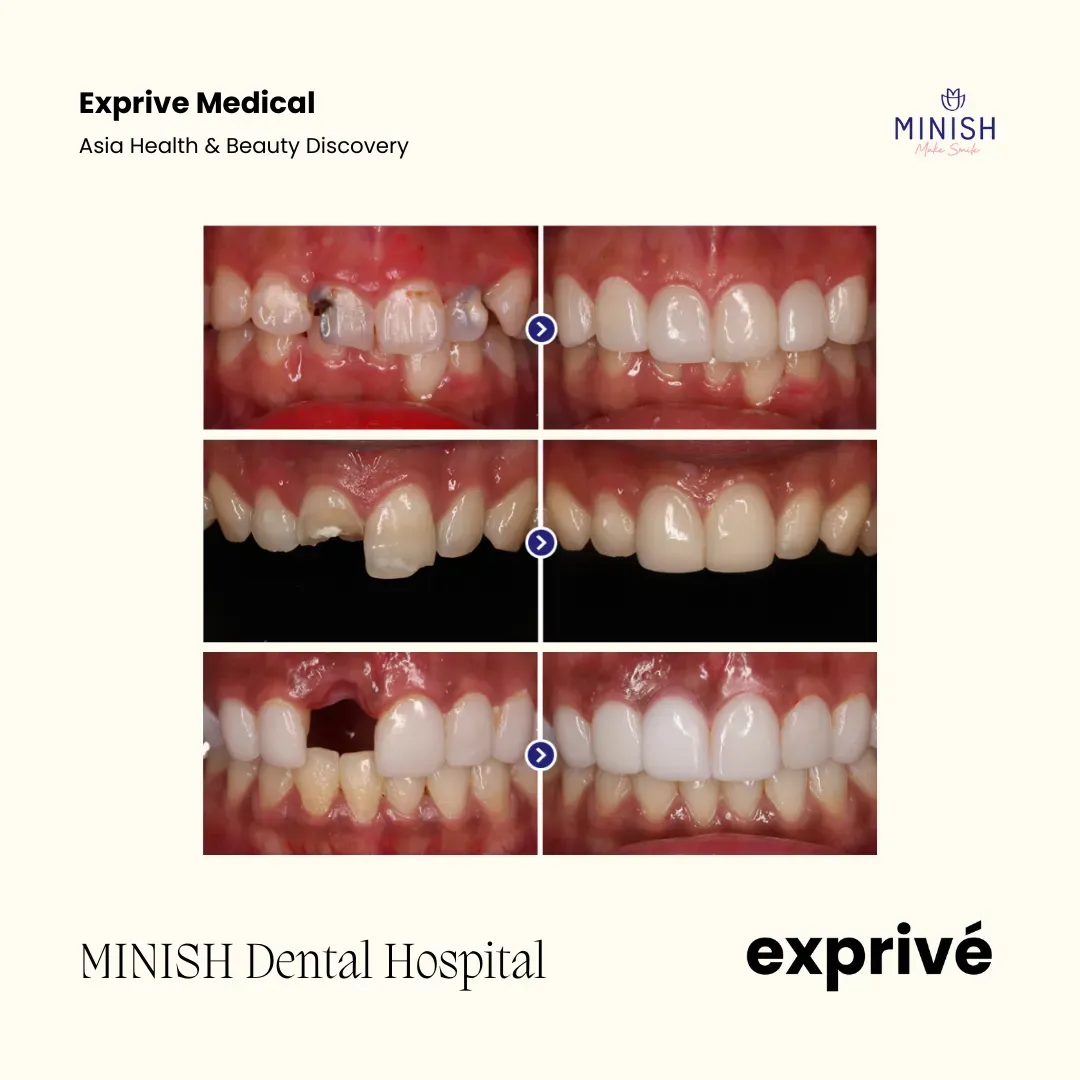 MINISH Dental Hospital