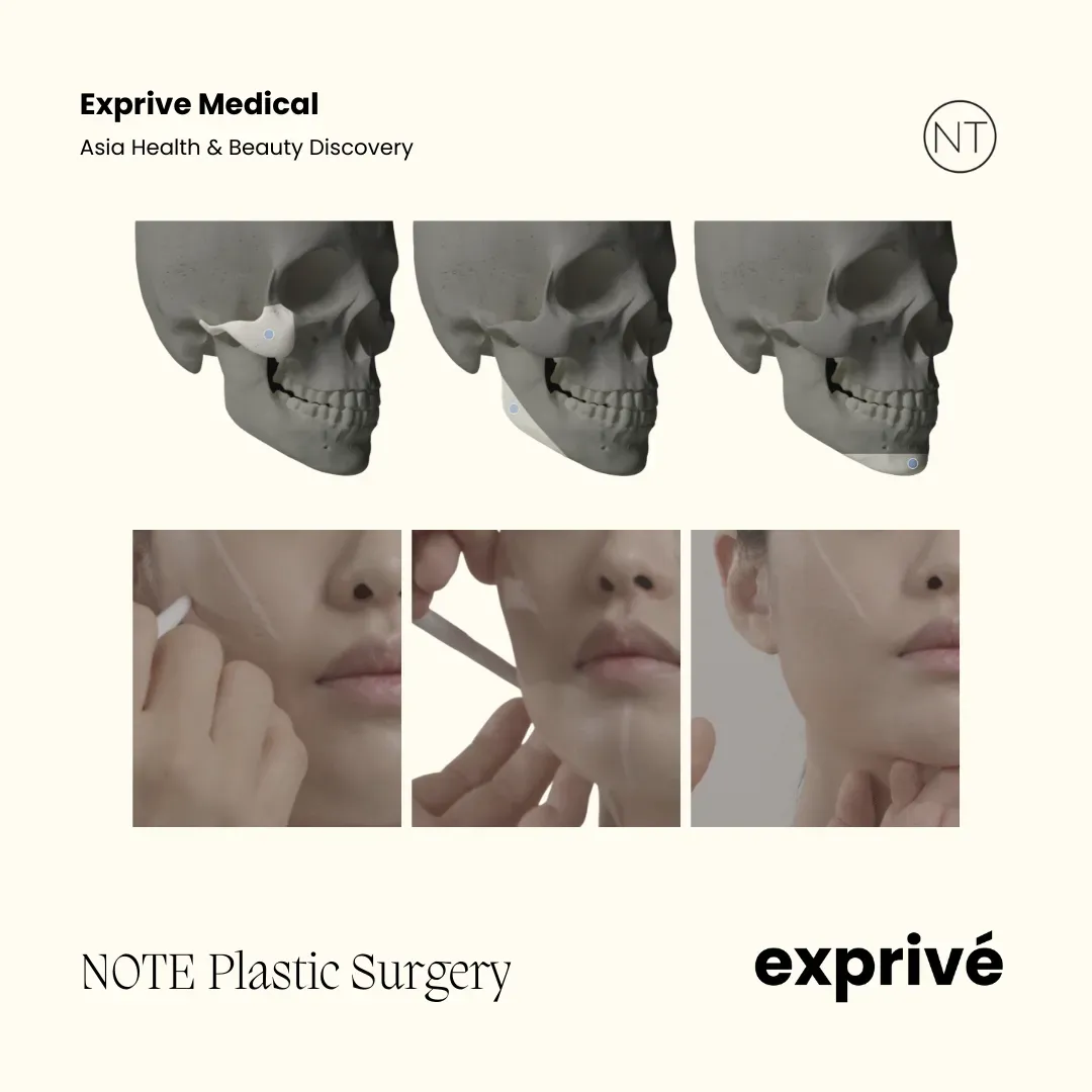 NOTE Plastic Surgery NOTE Plastic Surgery