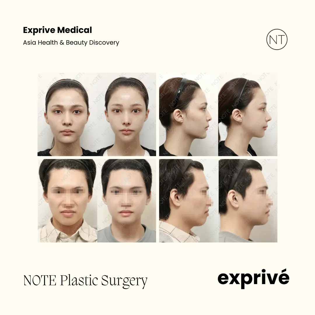 NOTE Plastic Surgery NOTE Plastic Surgery