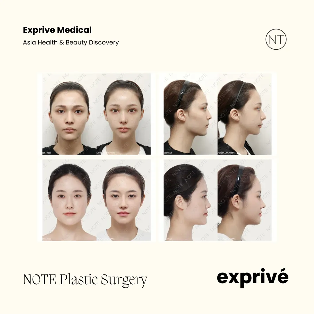 NOTE Plastic Surgery