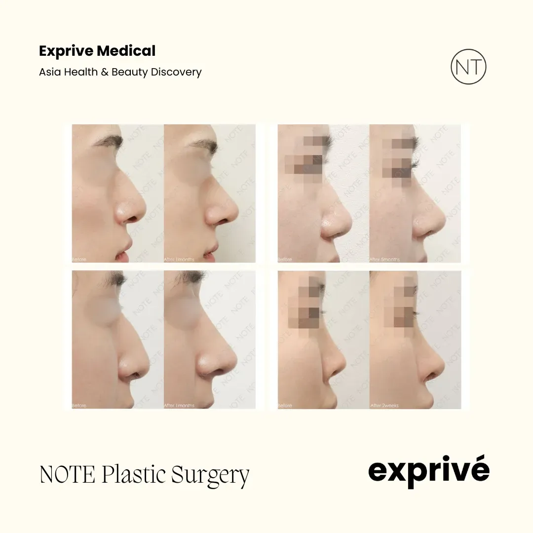 NOTE Plastic Surgery