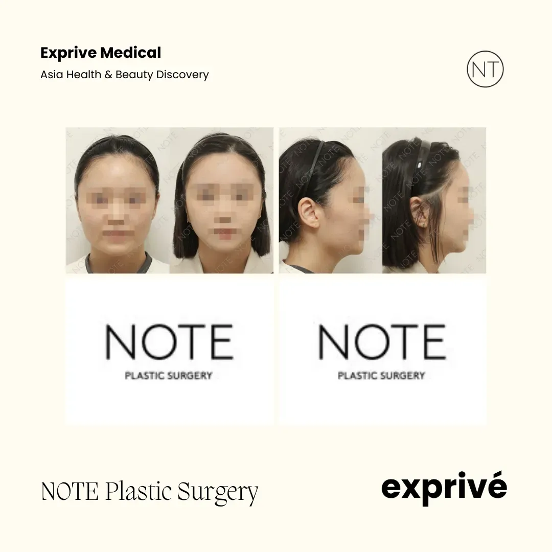 NOTE Plastic Surgery NOTE Plastic Surgery