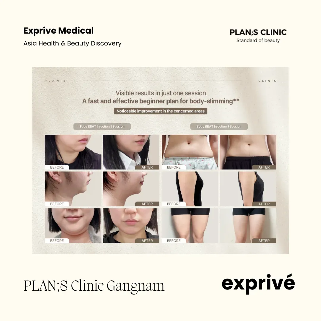 PLAN;S Clinic Gangnam
