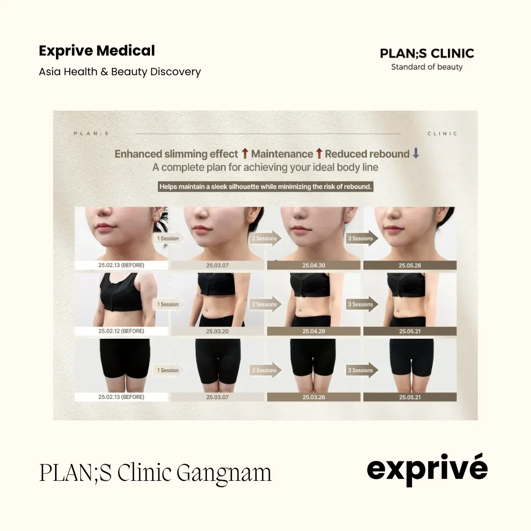 PLAN;S Clinic Gangnam