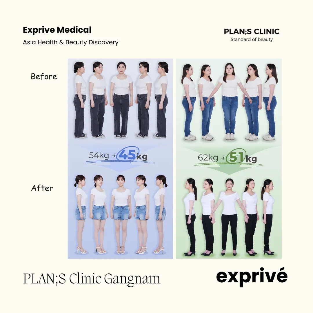 PLAN;S Clinic Gangnam