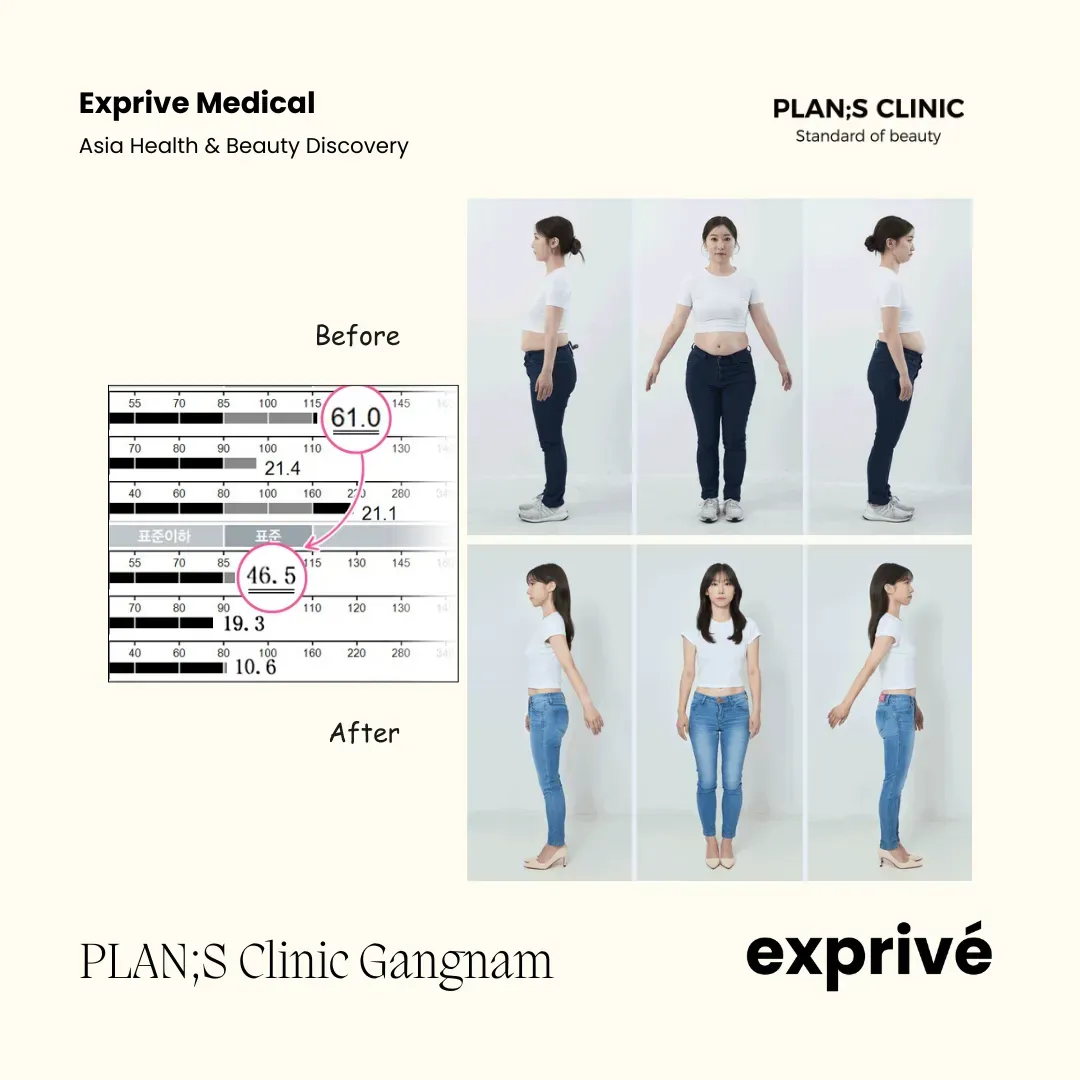 PLAN;S Clinic Gangnam