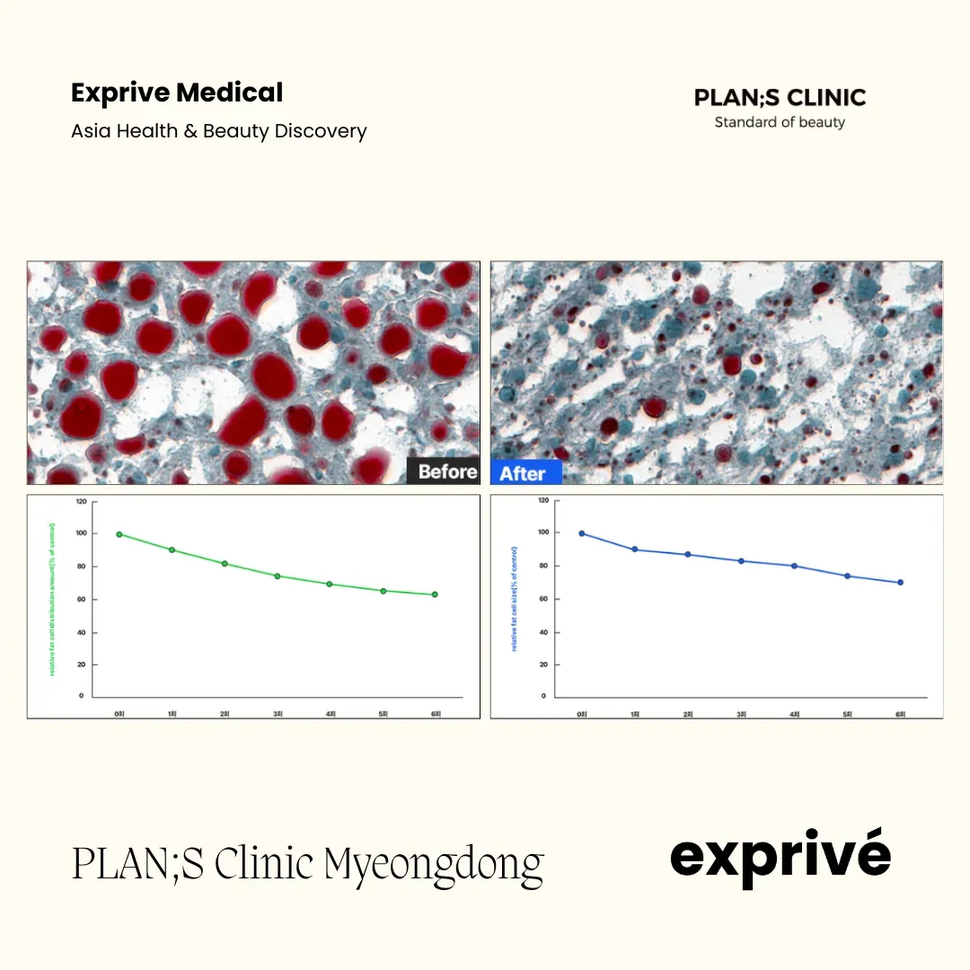 PLAN;S Clinic Myeongdong