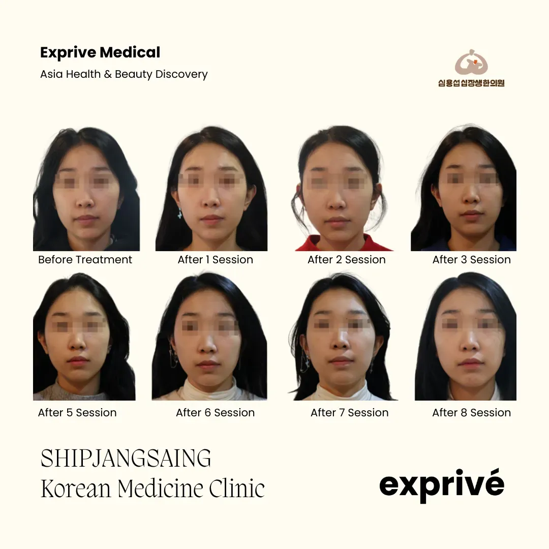 SHIPJANGSAING Korean Medicine Clinic