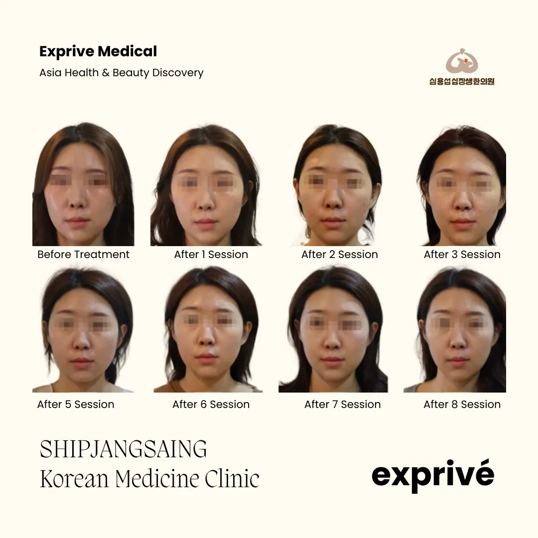 SHIPJANGSAING Korean Medicine Clinic