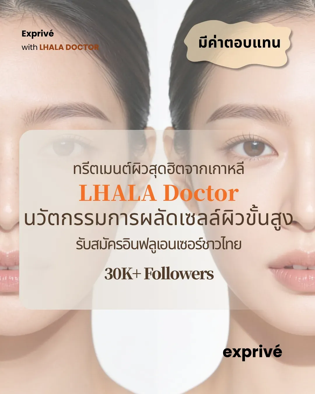[มีค่าตอบแทน] ทรีตเมนต์ผิวสุดฮิตจากเกาหลี LHALA Doctor | 🇹🇭 รับสมัครอินฟลูเอนเซอร์ชาวไทย (30K+ Followers)